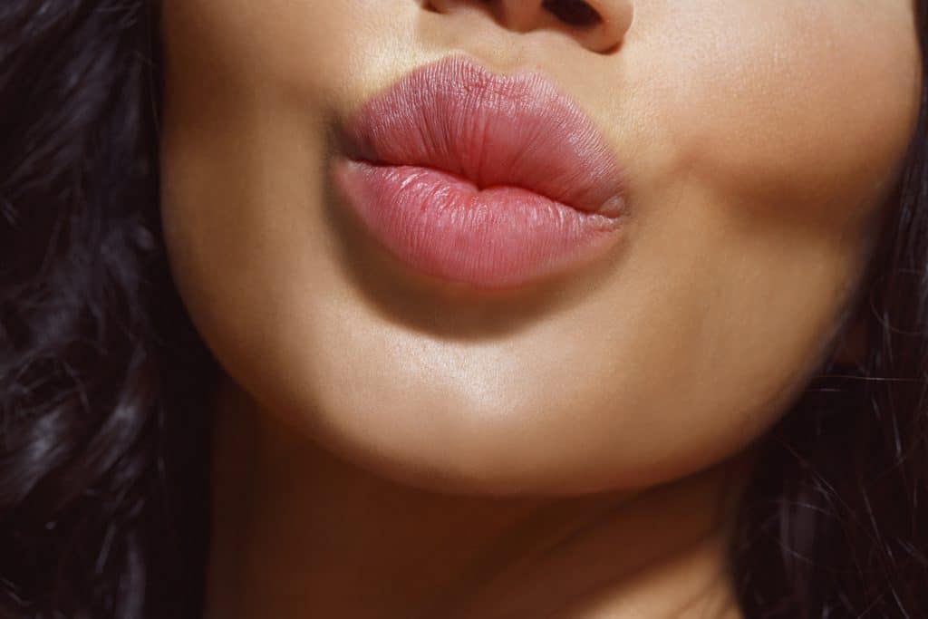 Lip Augmentation