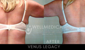 Venus Legacy - Back