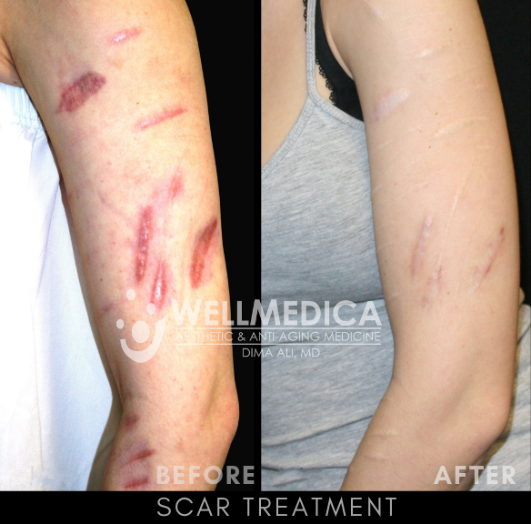 Before and After Dermatologist Photos - Reston, Washington DC