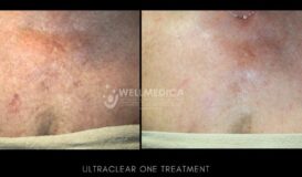 Ultraclear Chest website